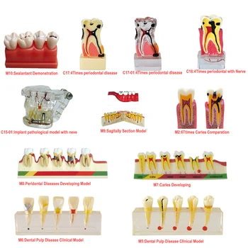 Stomatološke Oralne Obrazovne Obrazovni Model Ponekog Zuba Kontrast Demonstracija Анатомическая Stomatološki Model